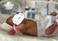 【暖新闻】提前10周出生，体重仅有650克 医护人员83天精心呵护助“巴掌宝宝”跑赢死神